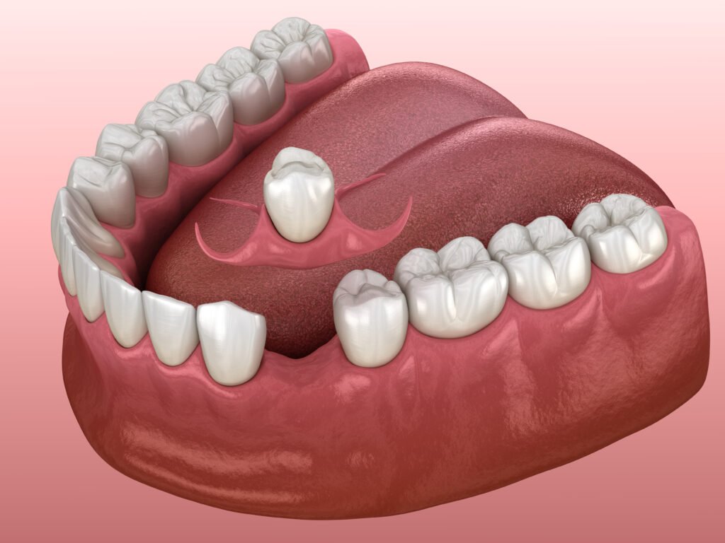 Tooth Knocked Out in Beverly Hills